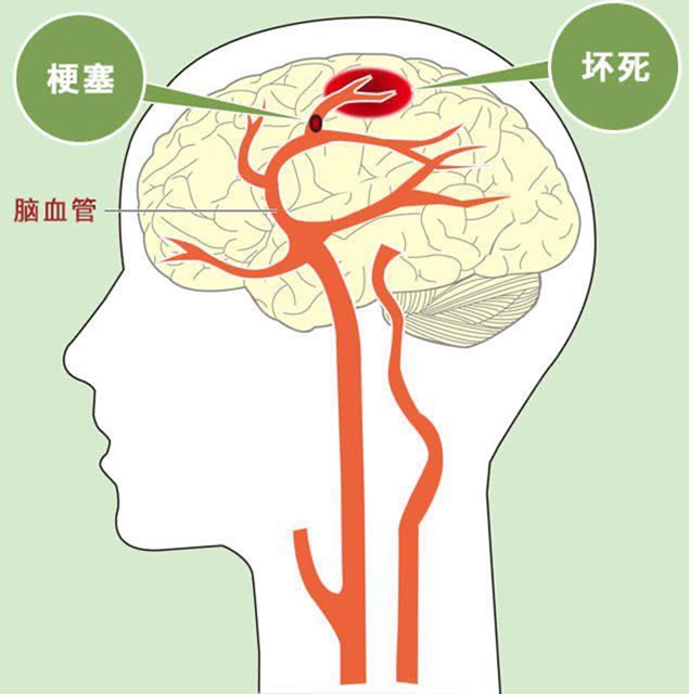 【冬季高發(fā)】6個危險信號一定要警惕！(圖4)