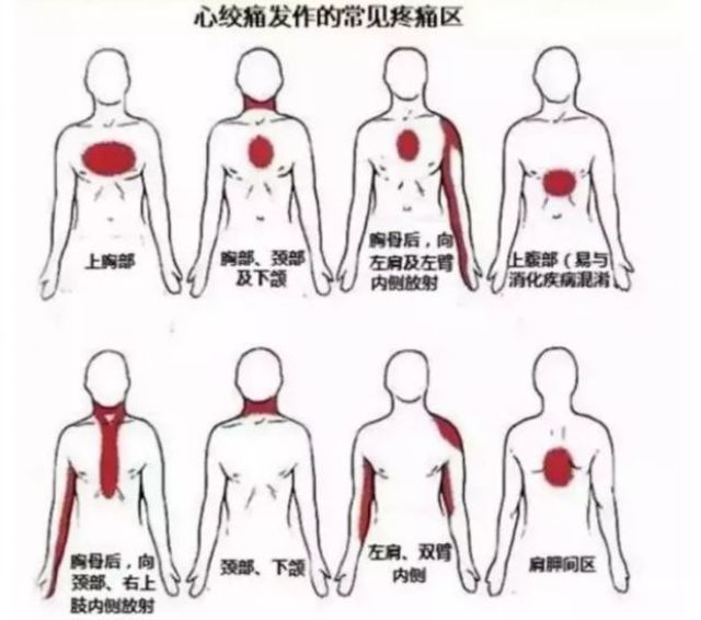 你的心臟在求救！急性心梗的這些預(yù)警信號(hào)， 你知道嗎？(圖8)